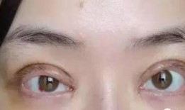 郑州双眼皮爆料案件最新,揭开整形行业潜规则真相